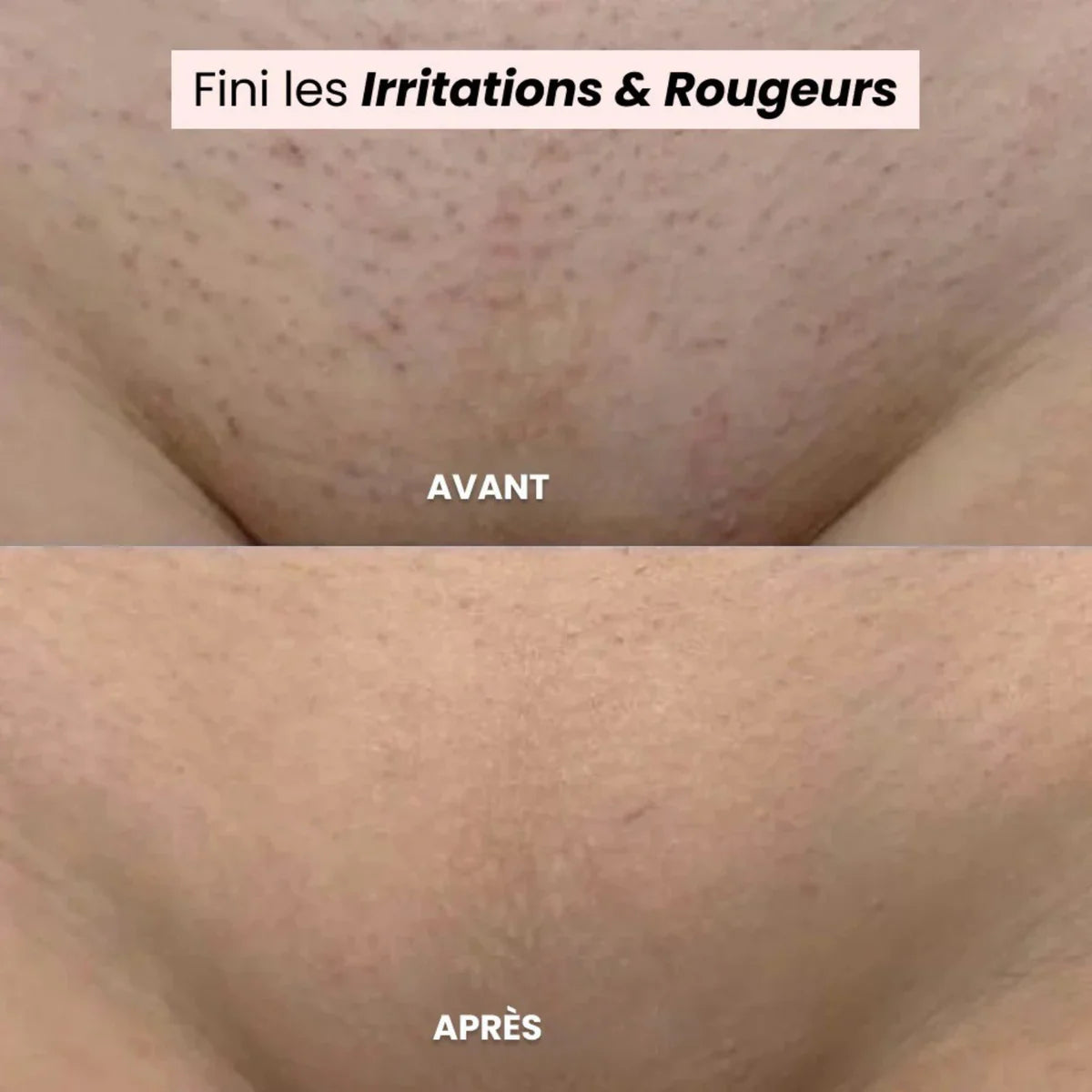 Rasoir MASERENEA™ - Retrouvez une peau lisse et douce, sans irritation ni douleur